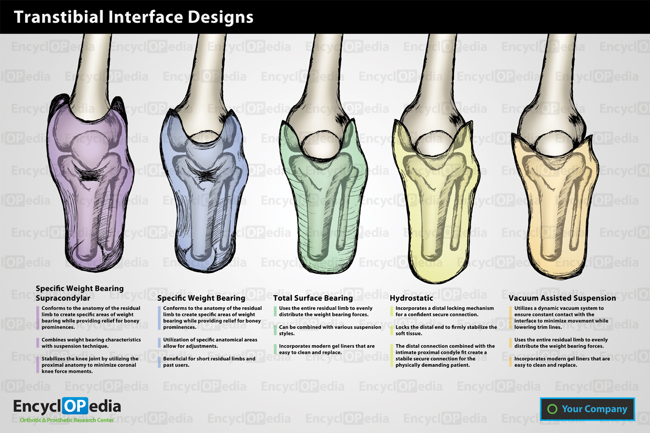 Prosthetic Interface Design